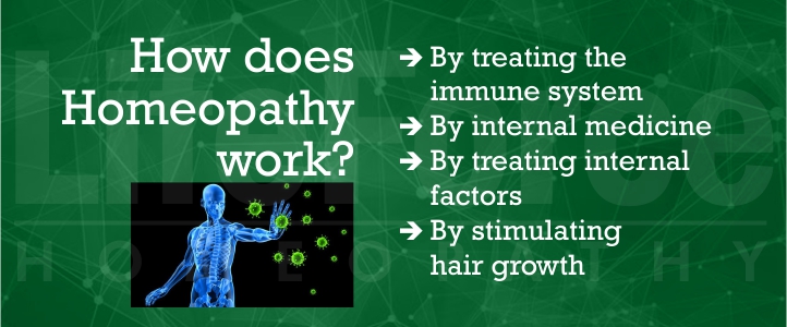 How does homeopathy work for alopecia areata